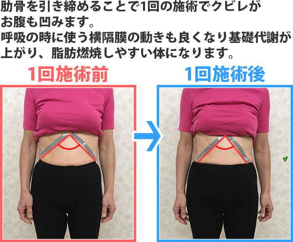 くびれビフォーアフター